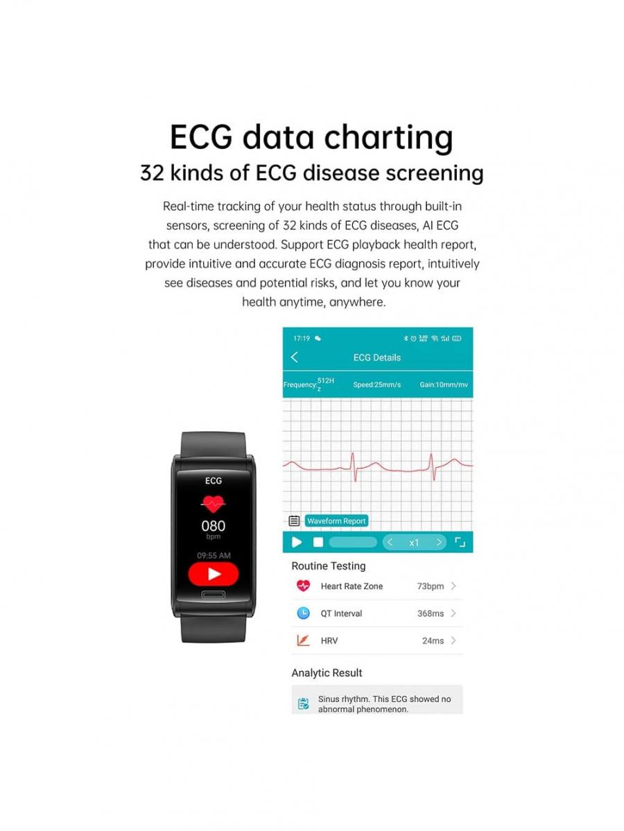 Smart Watch ECG PPG Blood Sugar Monitor Waterproof Fitness Tracker